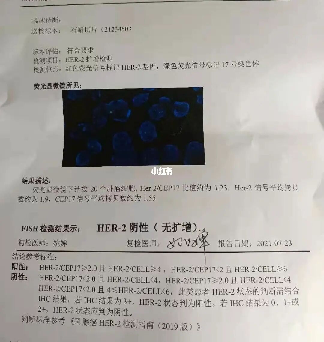 贝伐珠单抗_vegf贝伐珠单抗耐受_贝伐珠单抗不良反应