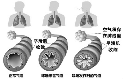 中国版奥希替尼_奥希替尼都有哪里产的_奥希替尼服用多长时间出现副作用