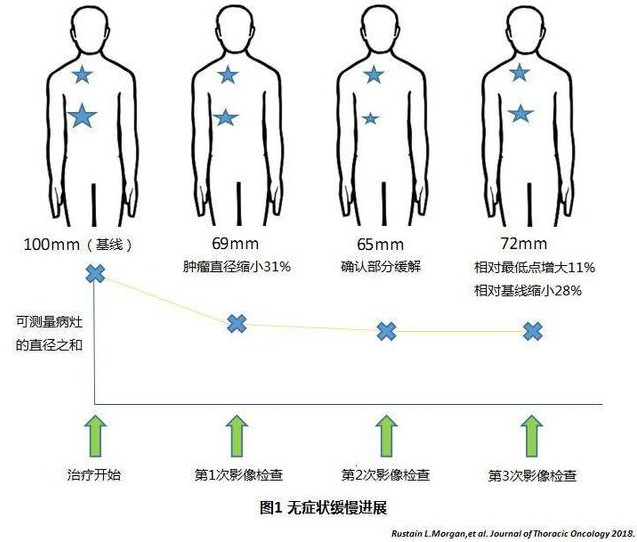 奥斯替尼和奥希替尼_9291奥希替尼价格_奥希替尼没用