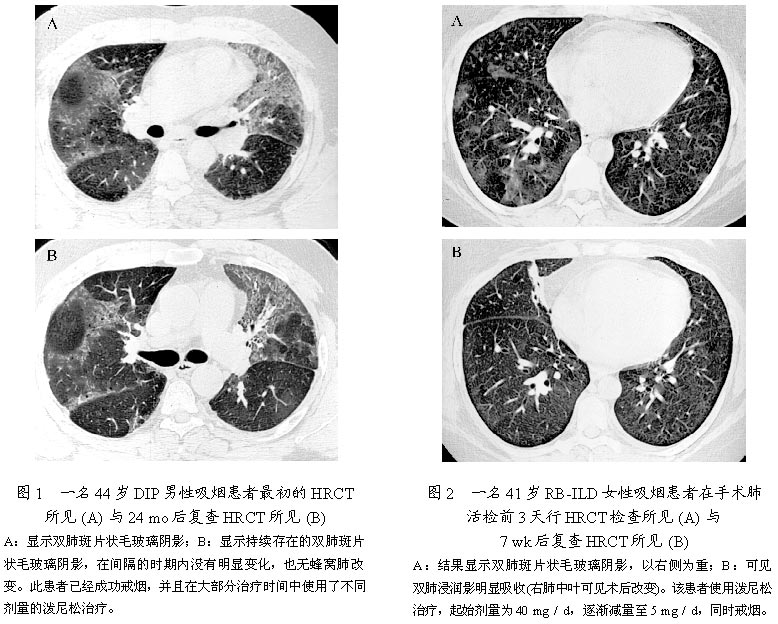 印度9291奥希替尼图片_奥斯替尼和奥希替尼_口服奥希替尼出现皮疹怎么办