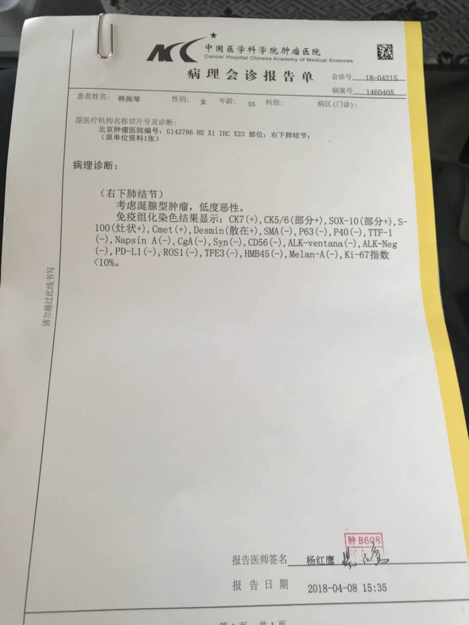 贝伐珠单抗价格_双免疫加贝伐单抗_贝伐珠单抗是靶向药吗