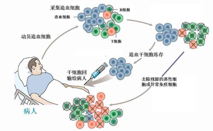 贝伐珠单抗价格_肺癌新药贝伐单抗_双免疫加贝伐单抗