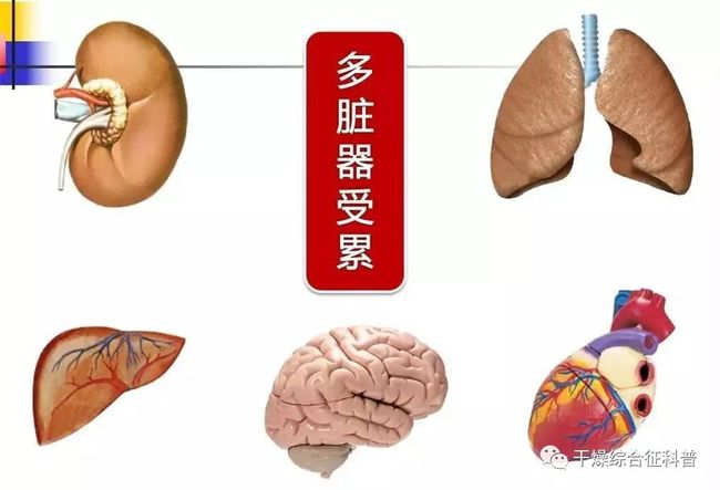 贝伐珠单抗4个月后赠药_贝伐珠单抗能治疗肝硬化吗_贝伐珠单抗是靶向药吗