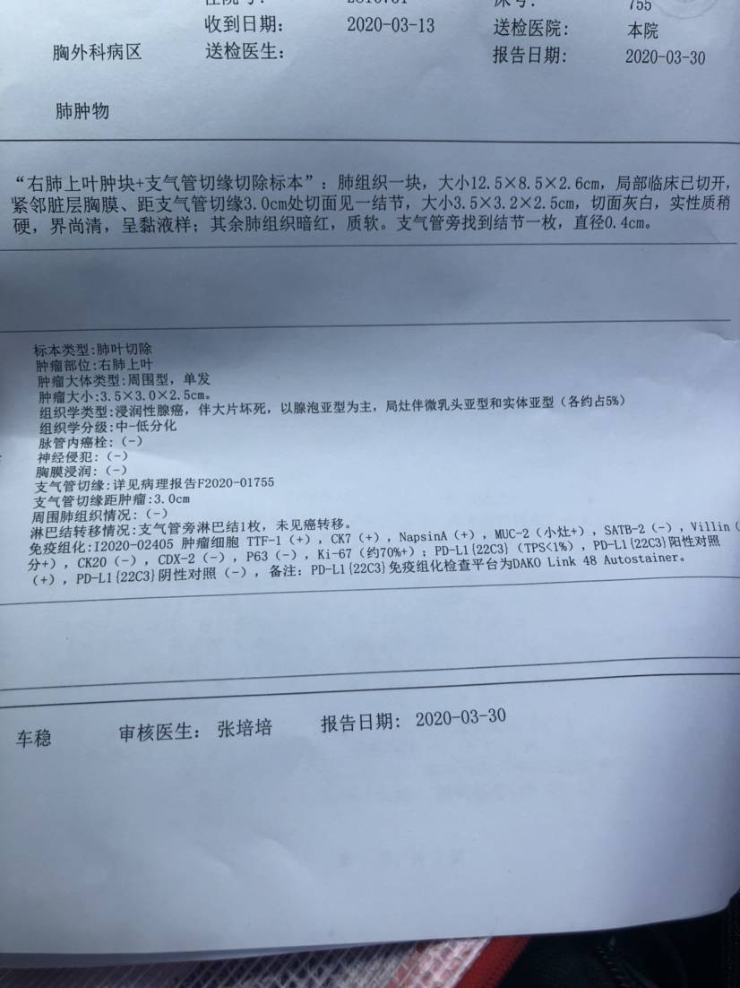 肺腺癌服用吉非替尼_浸润性腺癌肺5年存活率_肺乳头状腺癌恶性程度