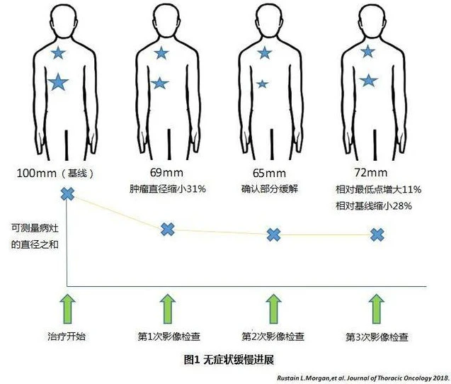 奥希替尼9291药品_进口奥希替尼_奥希替尼怎样服用最好