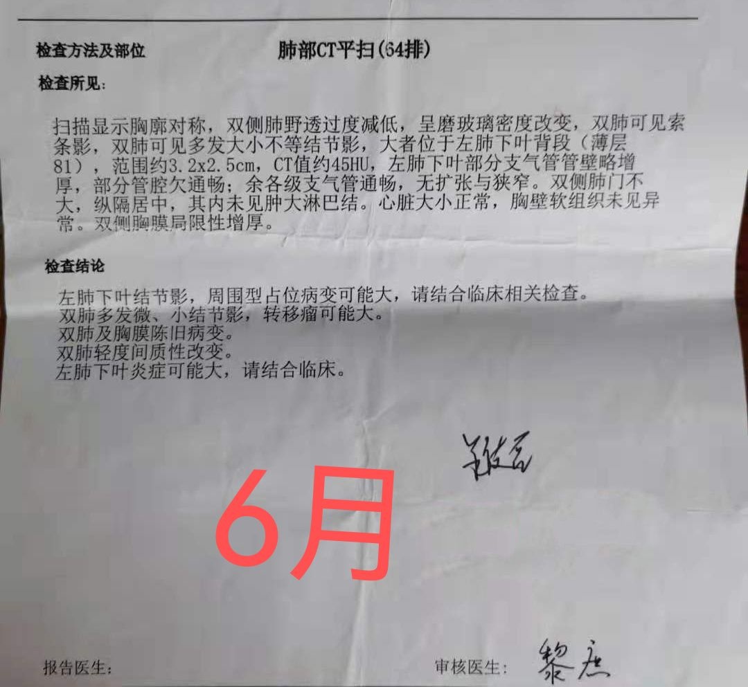 国产吉非替尼服用的患者多吗_服用索拉非尼 憨豆精神_国产苹果酸舒尼替尼胶囊