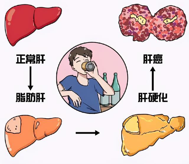 索拉非尼治疗hcc效果怎么样_索拉非尼 效果_印度索拉非尼效果