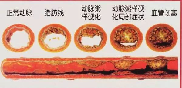 贝伐珠单抗说明书_贝伐珠单抗多少钱一支_贝伐单抗在妇科肿瘤用于