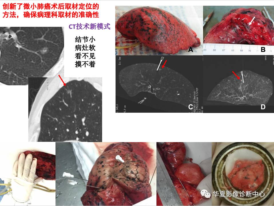 贝伐珠单抗价格_贝伐珠单抗治疗乳腺效果好不好_贝伐珠单抗多少钱一支