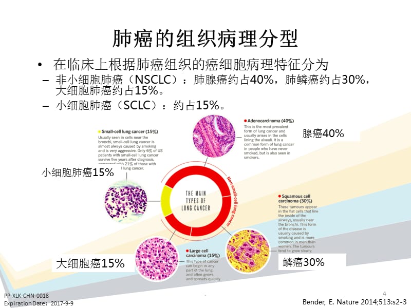 子宫内膜样腺癌分几级_子宫内膜样腺癌中医辅助治疗_吉非替尼药效治疗肺腺癌怎么样