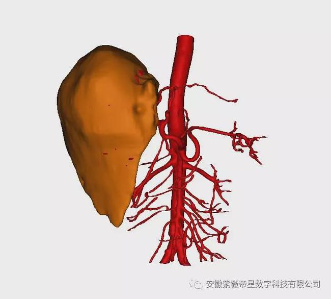 cfda 索拉非尼 肝癌_肝癌吃索拉非尼多久起效_肝癌晚期吃索拉非尼