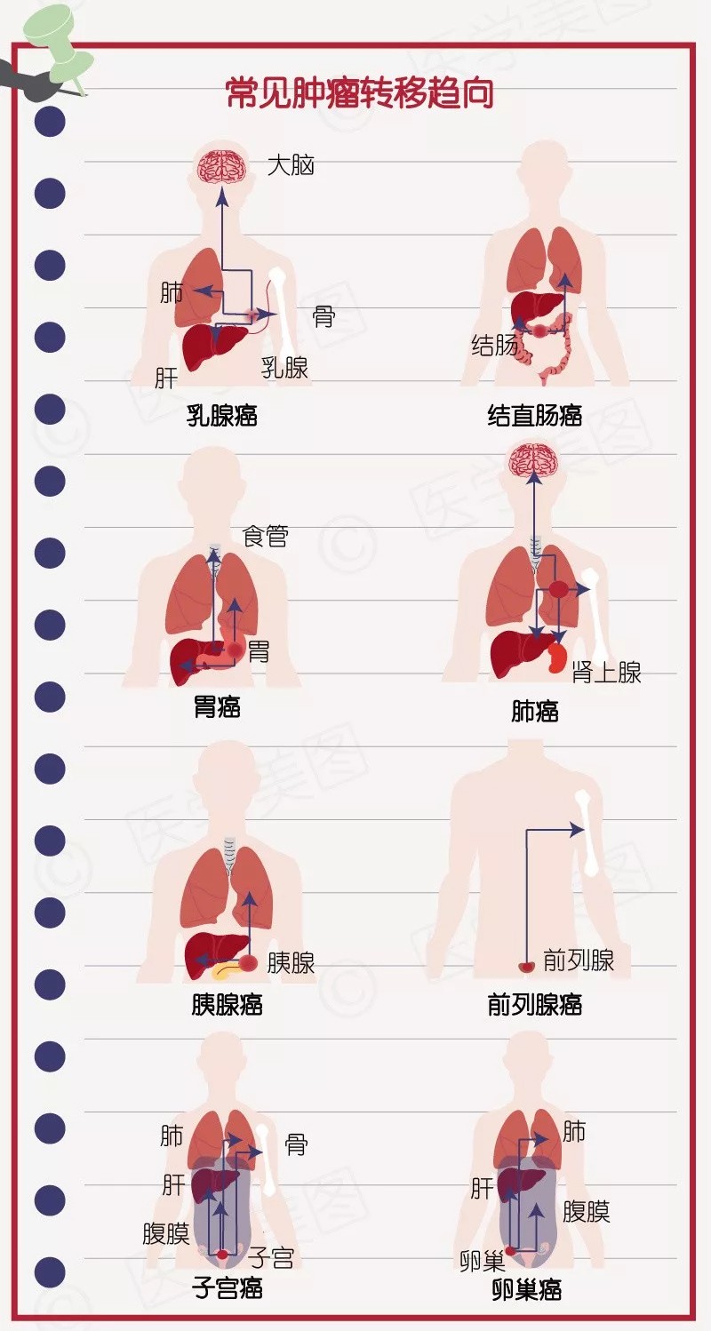 贝伐珠单抗是化疗吗_结肠癌伴肝转移靶向贝伐珠单抗_贝伐单抗能治好直肠癌