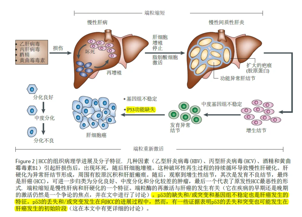 酒精性肝癌与索拉非尼_索拉非尼吃好了肝癌_索拉非尼肝癌延长时间