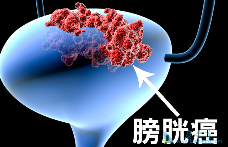 吉非替尼剂量和方法_甲泼尼注射剂量_伊布替尼 剂量