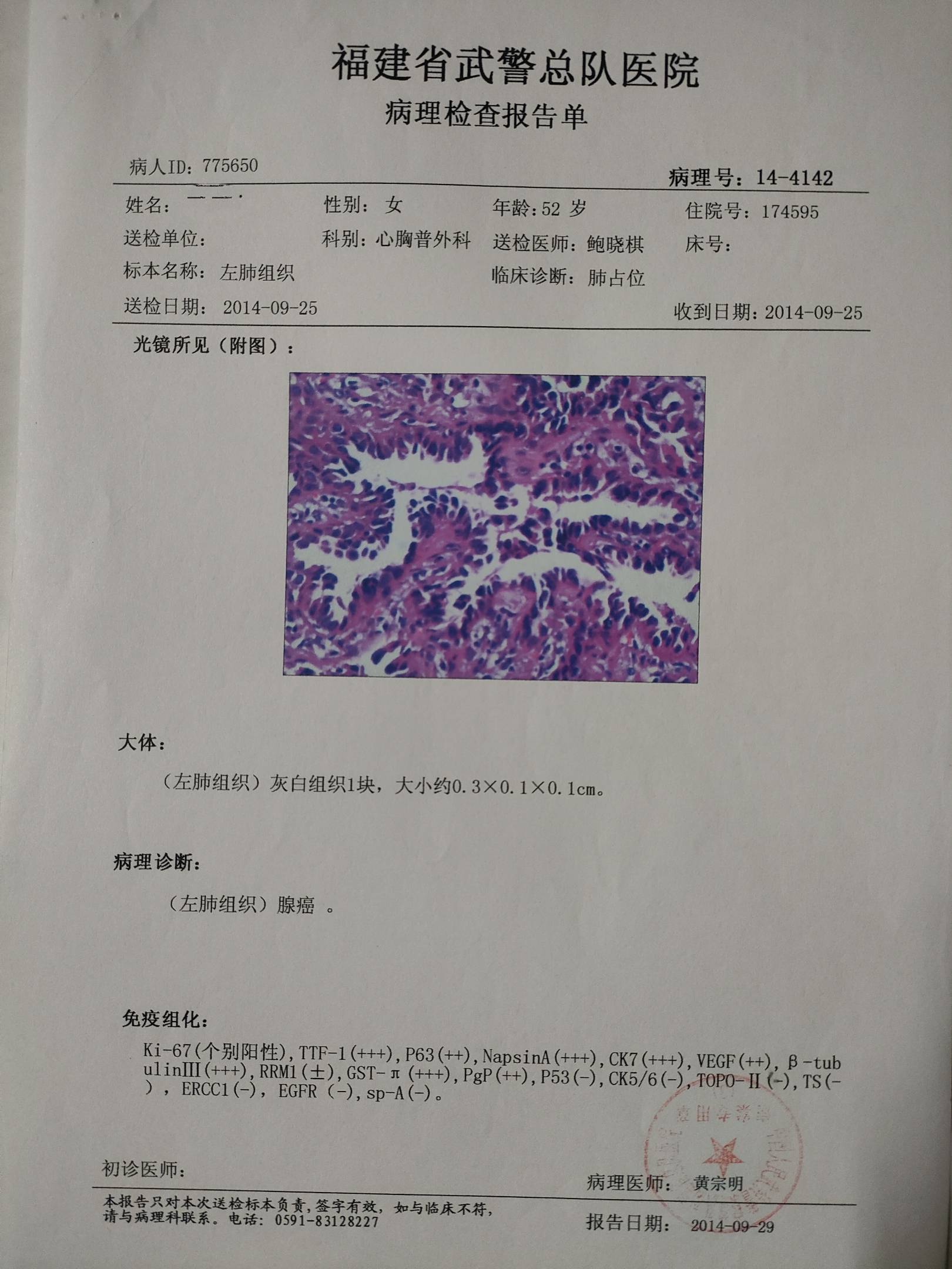 吉普希.凡尼尔马_吉非替尼片剂多少钱一盒_尼塔库碳吉他和男高音