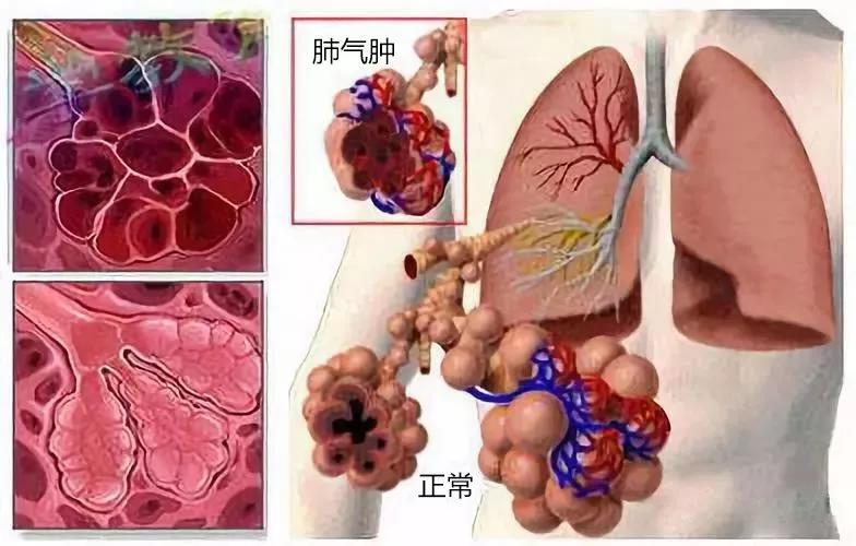 靶向药第三代奥希替尼_奥希替尼9291哪里买_9291奥希替尼价格