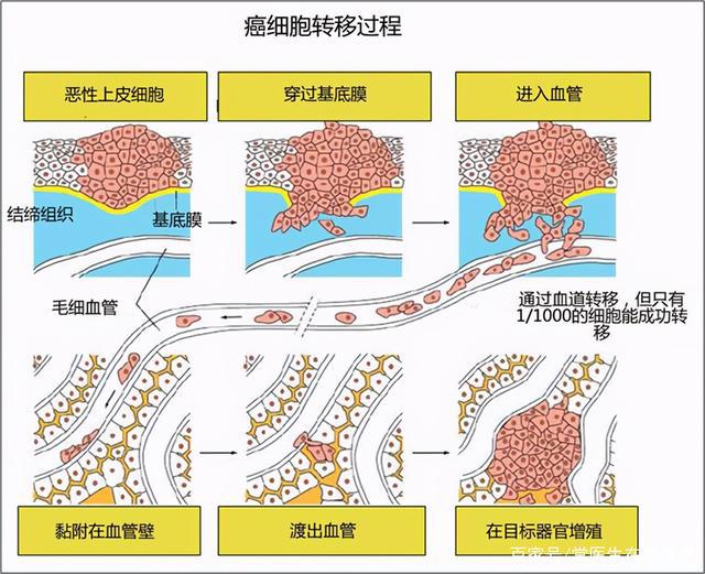 贝伐珠单抗是化疗吗_贝伐珠单抗是第几代靶向药物_贝伐珠单抗是靶向药吗