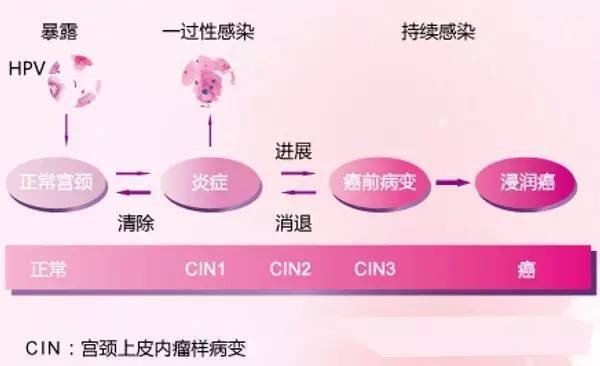 贝伐单抗治疗宫颈癌吗_贝伐单抗和贝伐珠单抗_贝伐珠单抗注射液