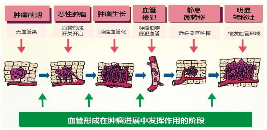 贝伐珠单抗_贝伐珠单抗说明书_低剂量贝伐单抗胶质瘤