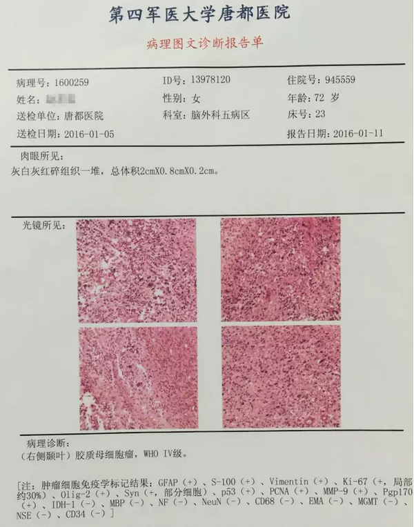 贝伐单抗会引起出血么_贝伐单抗耐药性_西妥昔单抗贝伐单抗