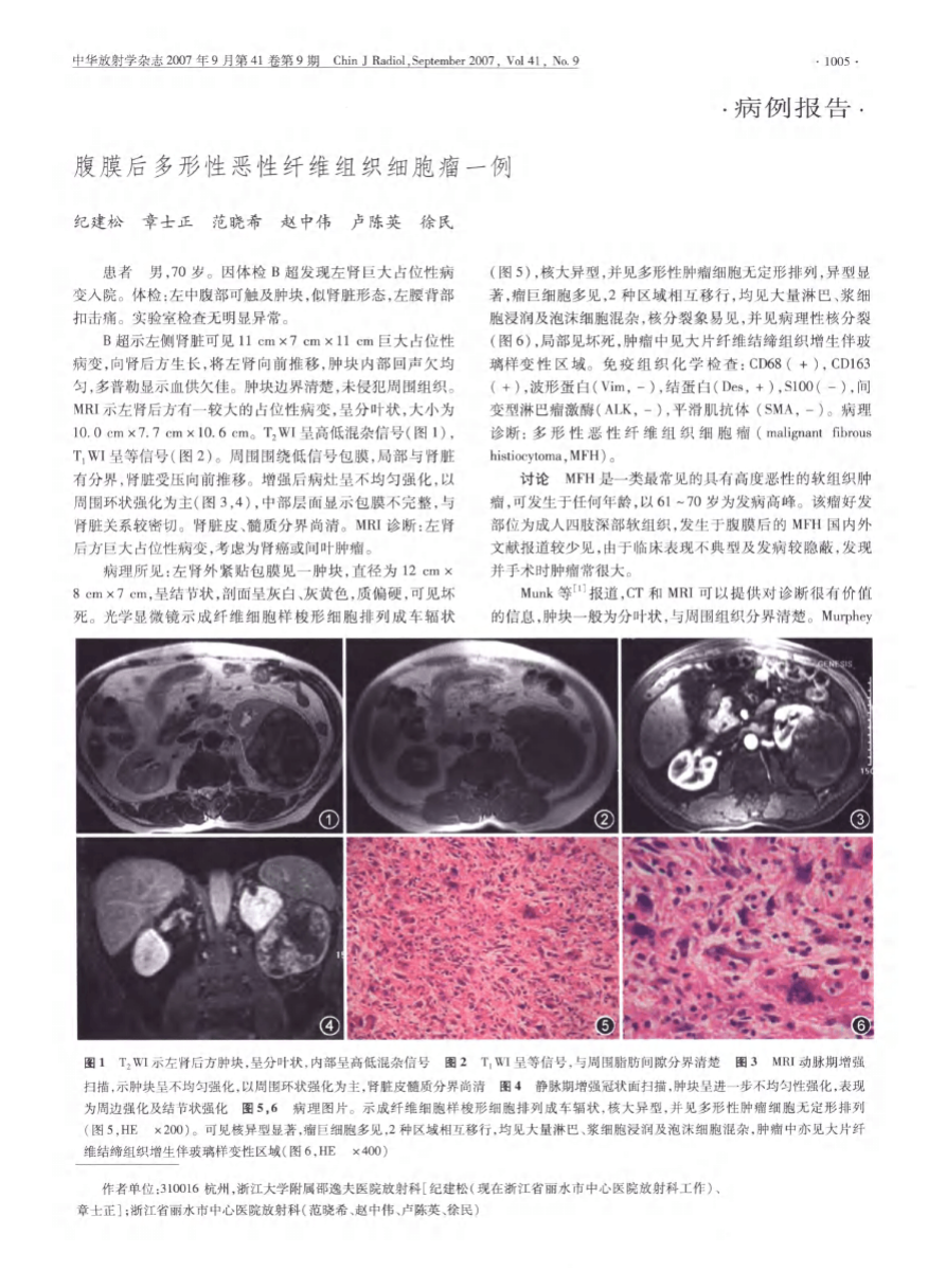 贝伐珠单抗最新价格_贝珠伐单抗治胶质瘤吗_贝伐珠单抗是靶向药吗