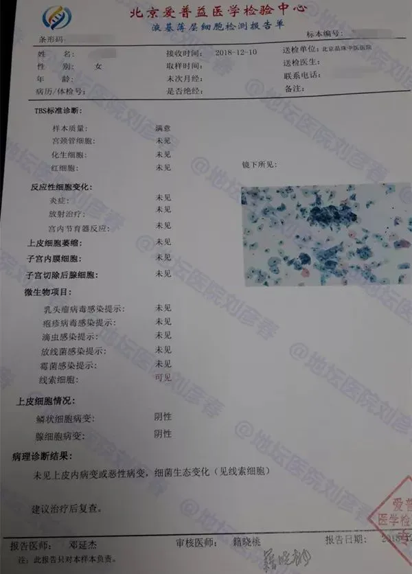 贝伐珠单抗治疗复发性宫颈癌_贝伐珠单抗价格_贝伐单抗对脑转移癌有效