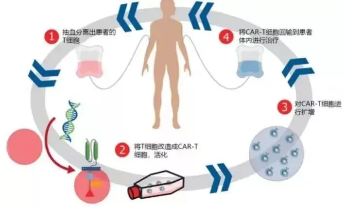 乳腺导管内癌 原位癌_乳腺导管内癌原位癌_吉非替尼乳腺癌