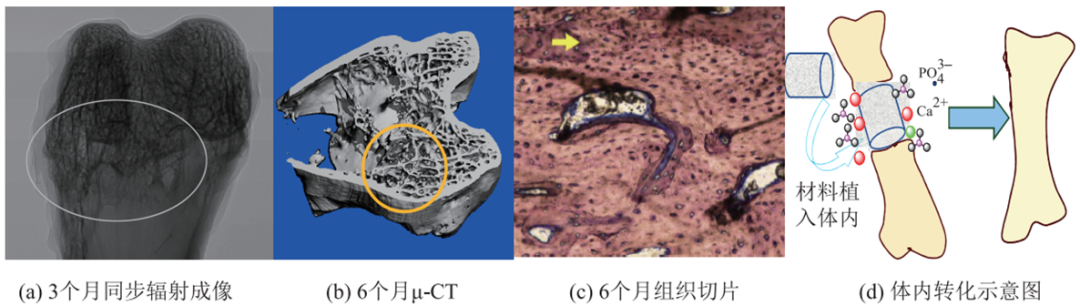 贝伐单抗印度版_贝伐单抗是靶向药吗_贝伐单抗和白蛋白