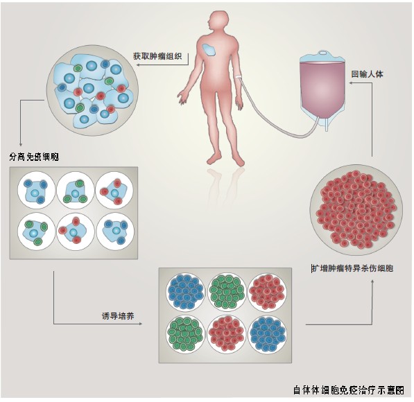 贝伐珠单抗多少钱一支_贝伐珠单抗最新价格_贝伐珠单抗一次多少