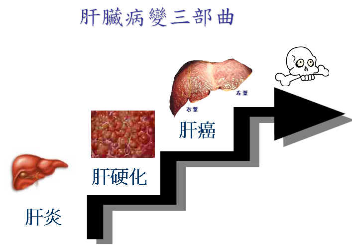 索拉非尼 肝癌 缺点_索拉非尼吃好了肝癌_肝癌无法手术索拉非尼