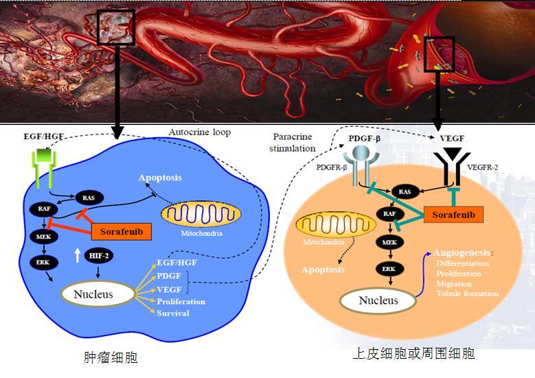 索拉非尼停药指征_索拉非尼 肝癌_索拉非尼价格