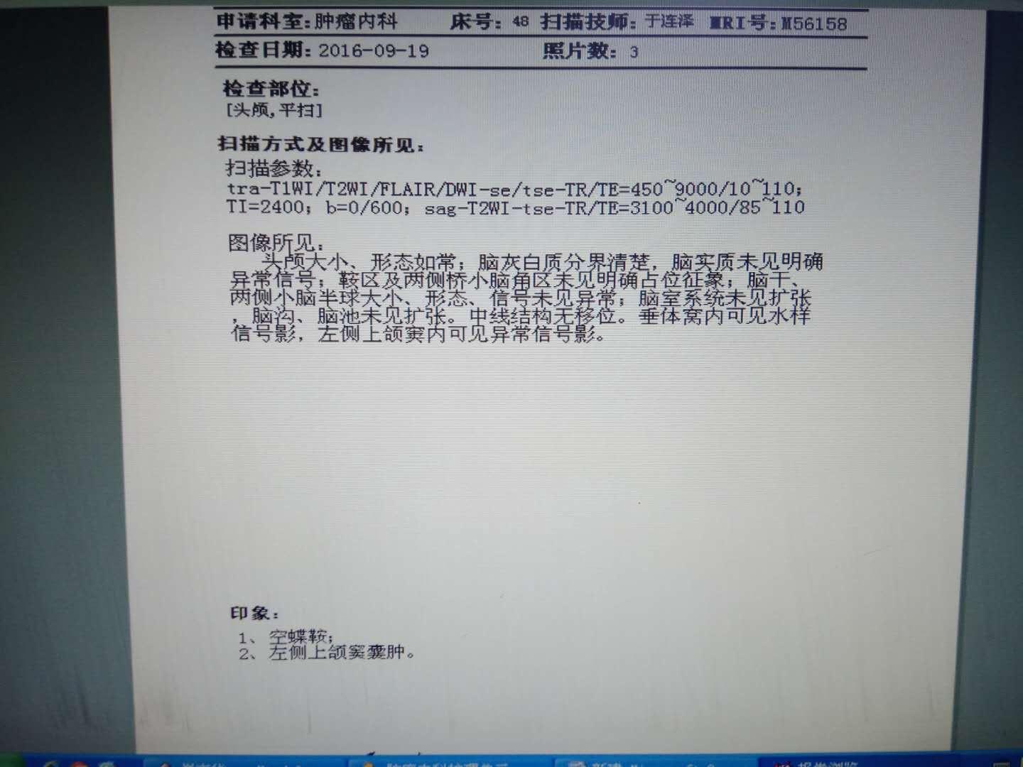 打贝伐单抗计量_肺癌新药贝伐单抗_贝伐珠单抗是化疗药吗