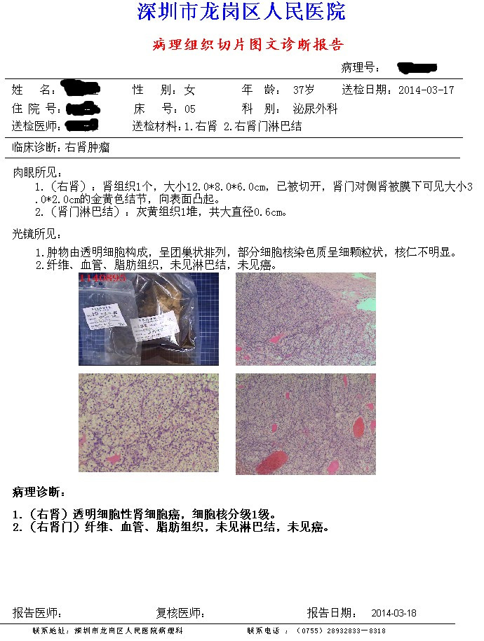 贝伐珠单抗治疗宫颈癌复发_贝伐珠单抗赠药_贝伐珠单抗靶向是啥