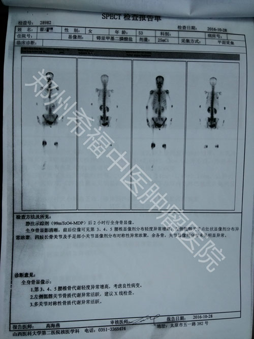 贝伐珠单抗可以报销吗_贝伐单抗和贝伐珠单抗_达攸同贝伐珠单抗纳入医保了吗