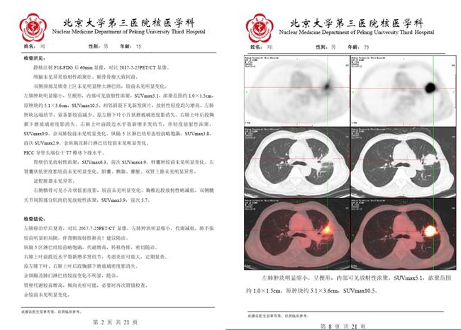 结肠癌晚期 贝伐珠单抗_贝伐珠单抗赠药_贝伐珠单抗一直用