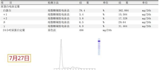 贝伐珠单抗是化疗吗_肝手术后化疗能用贝伐单抗_贝伐珠单抗注射液