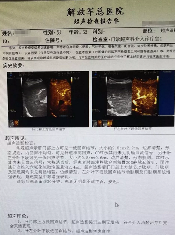 贝伐珠单抗 耐药性_贝伐珠单抗信达效果_贝伐珠单抗的副作用