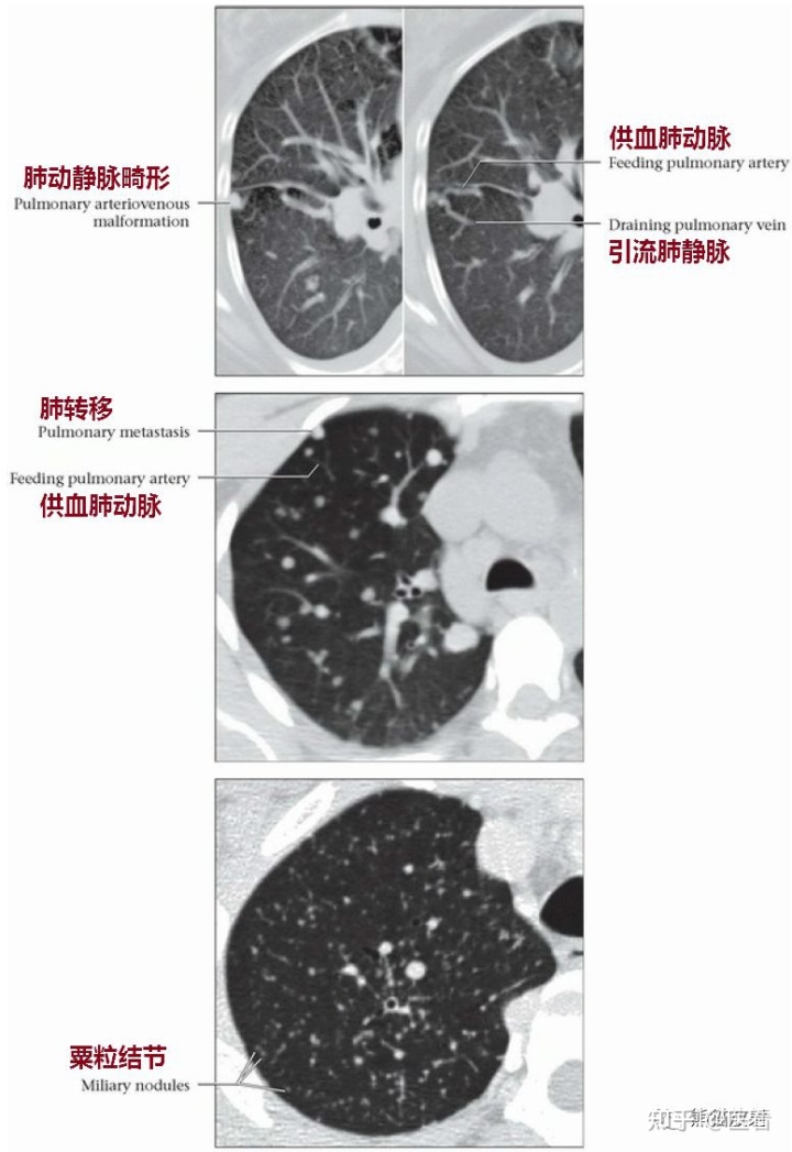 贝伐珠单抗是靶向药吗_输贝伐单抗容易引起静脉血栓吗_贝伐珠单抗说明书