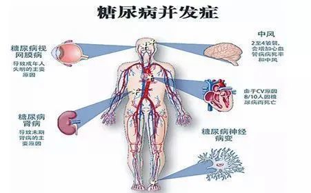 贝伐珠单抗靶向是啥_贝伐单抗和贝伐珠单抗_乳腺癌贝伐单抗滴注要求