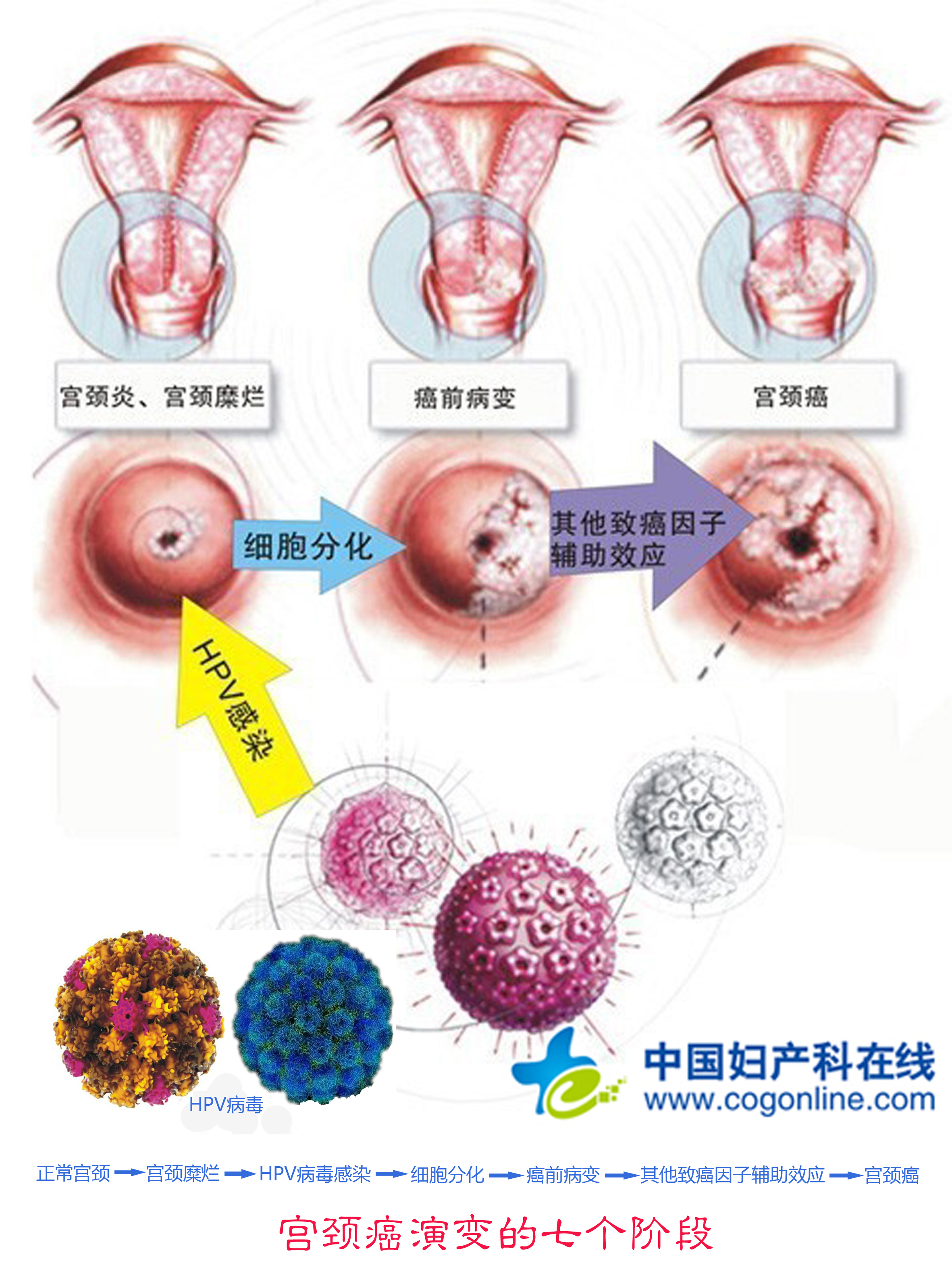 宫颈癌复发能用贝伐单抗吗_贝伐单抗用多久会耐药_贝伐珠单抗多少钱一支