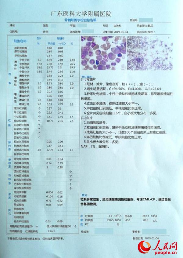 azd 9291 奥希替尼_azd9291奥希替尼_奥希替尼治疗好吗