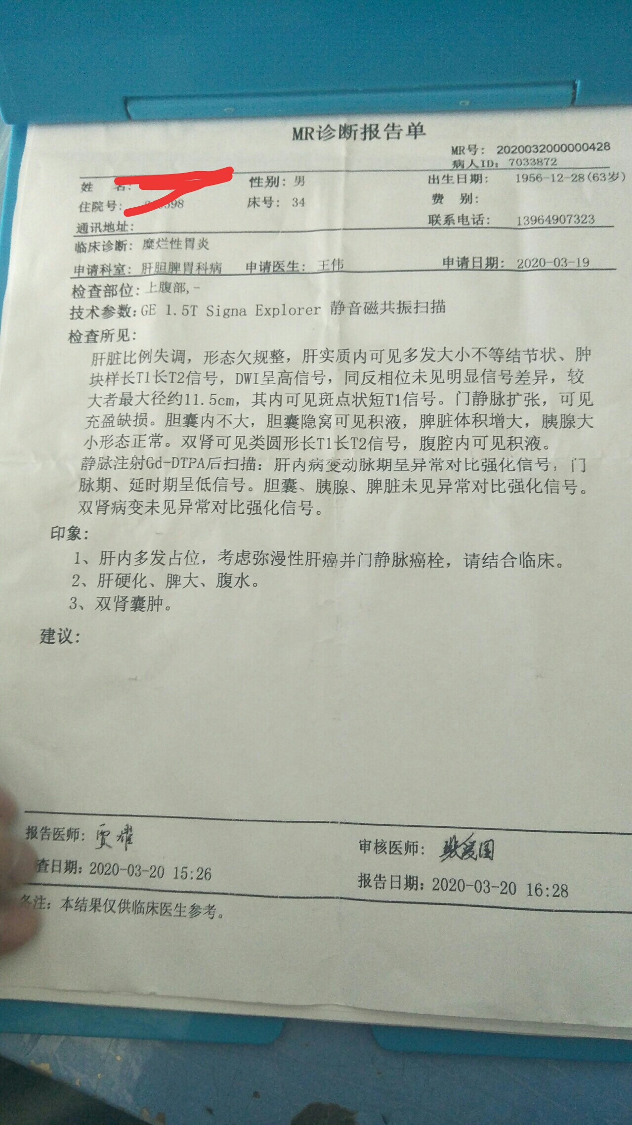 贝伐珠单抗是靶向药吗_贝伐单抗多久有耐药性_贝伐单抗致肠穿孔概率