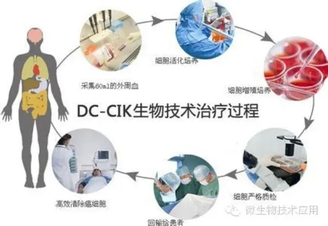 贝伐珠单抗可以报销吗_贝伐珠单抗与pd1肝癌_贝伐珠单抗不良反应