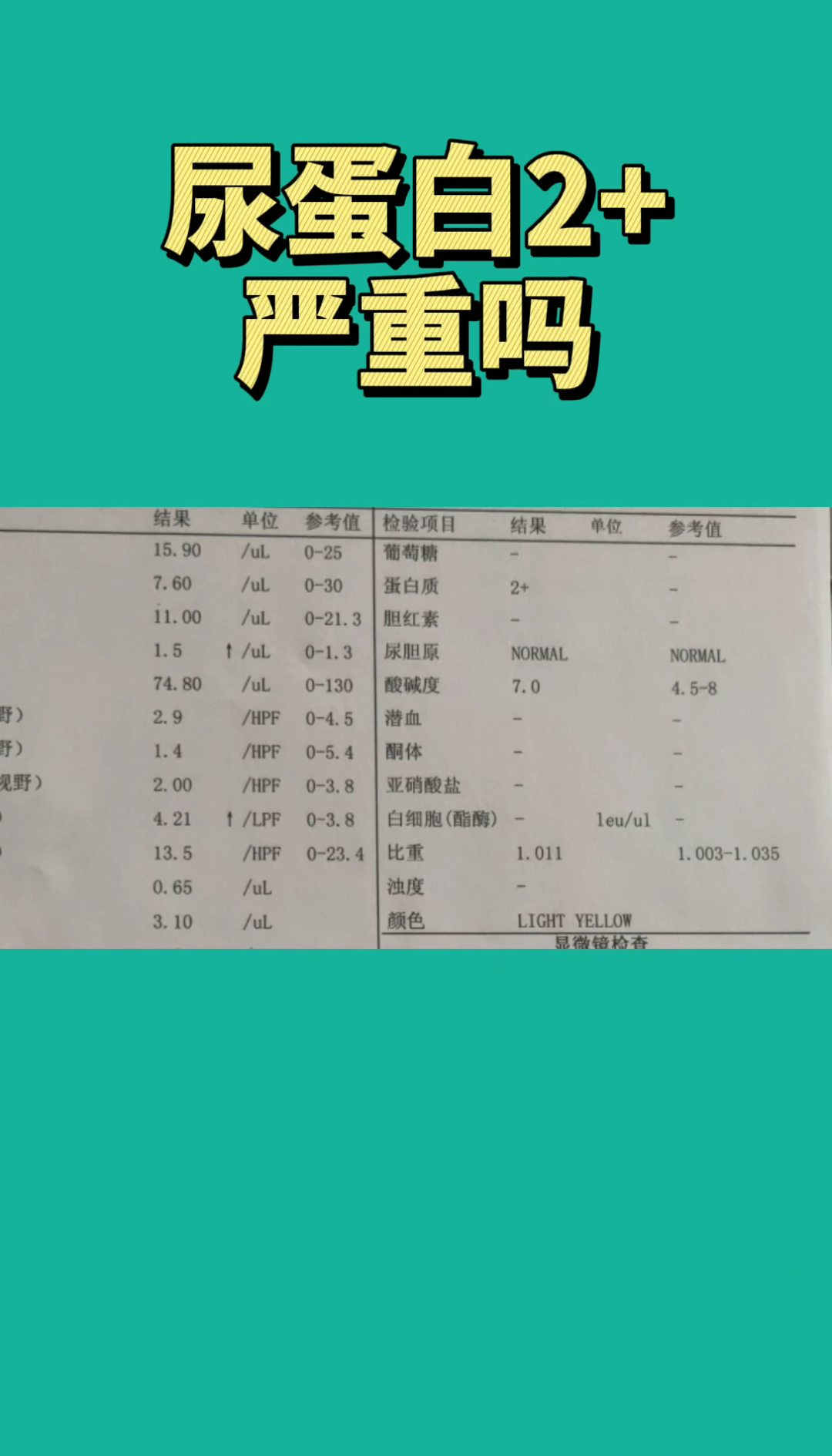 贝伐珠单抗赠药_贝伐珠单抗能治_贝伐单抗和贝伐珠单抗