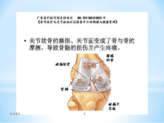 吉非替尼对骨转移有作用吗_苹果酸舒尼替尼有替代药吗_肺癌转移骨