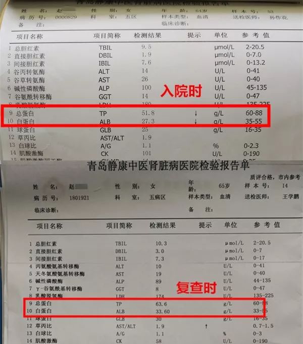 贝伐珠单抗价格_贝伐珠单抗副作用发生时间_贝伐珠单抗赠药