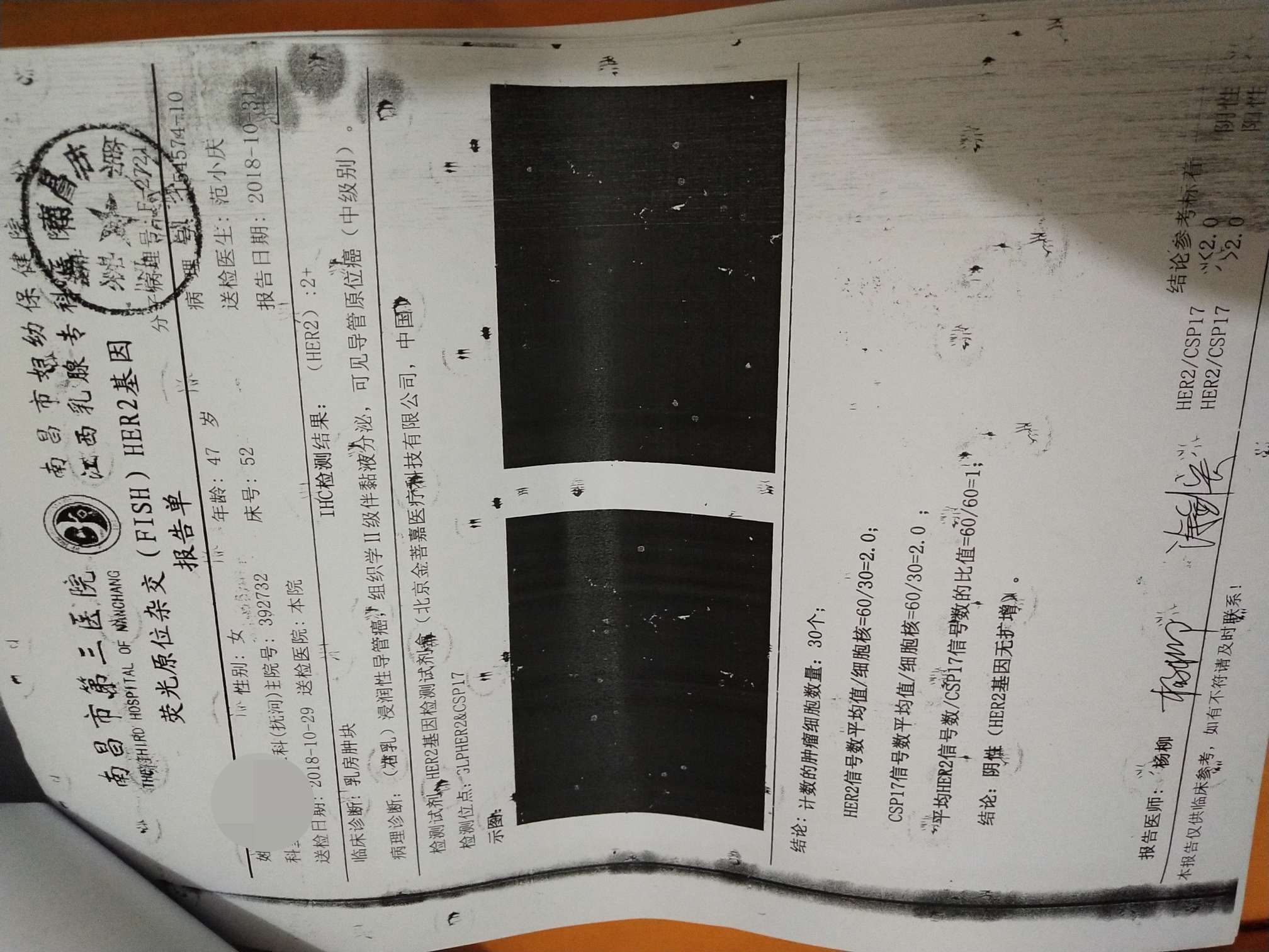 贝伐珠单抗的副作用_贝伐珠单抗多少钱一支_贝伐珠单抗药液腐蚀皮肤