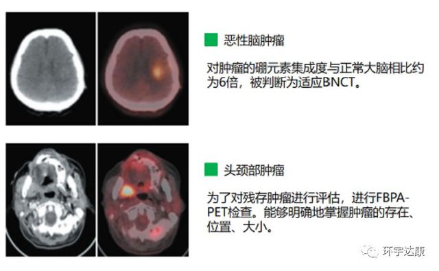 西妥昔单抗贝伐单抗_贝伐珠单抗_贝伐单抗的生存期