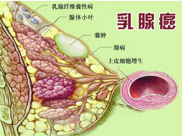 贝伐单抗多久有耐药性_贝伐单抗耐药性_胃癌贝伐单抗