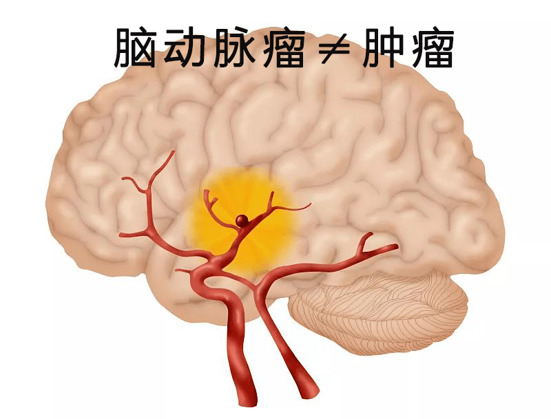 印度版奥希替尼_奥希替尼对骨转移效果如何_奥希替尼印度版怎么买